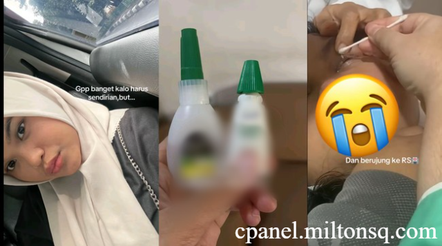Salah Ambil Lem Instan Saat Tetes Mata, Kisahnya Viral