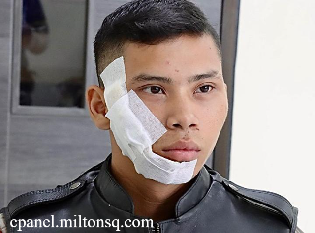 Viral! Petugas Keamanan Disiram Air Keras